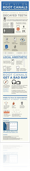 Root Canals Infographic